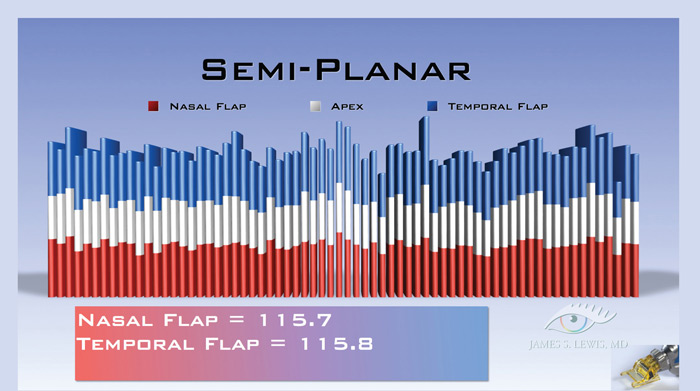 Semi-Planar